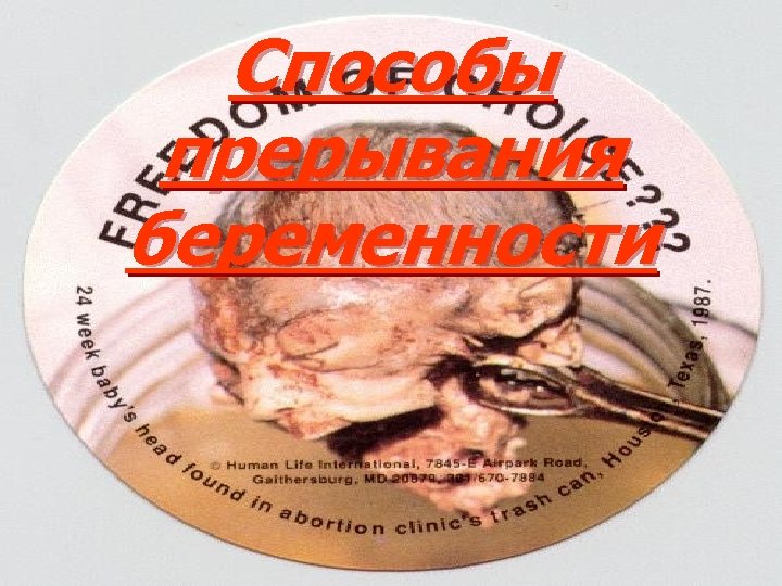 Способы прерывания беременности 