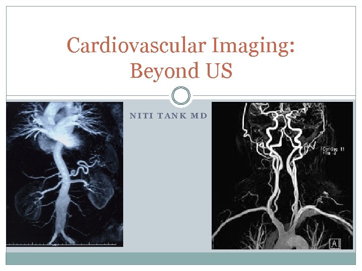 Cardiovascular Imaging: Beyond US NITI TANK MD 