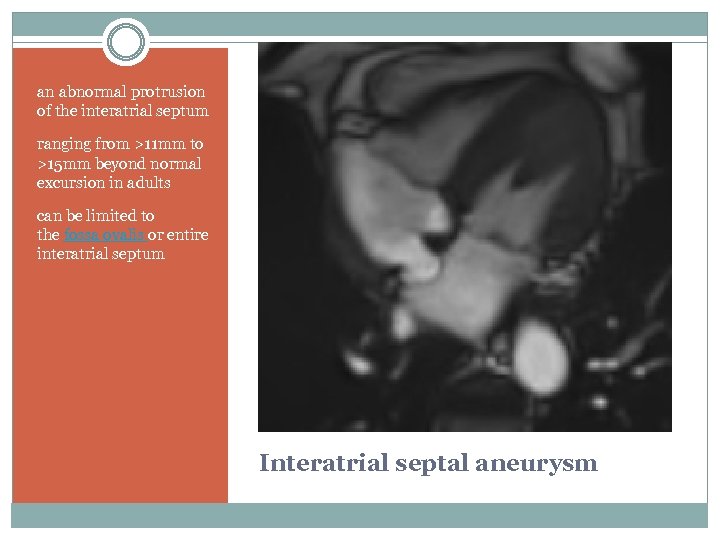 an abnormal protrusion of the interatrial septum ranging from >11 mm to >15 mm