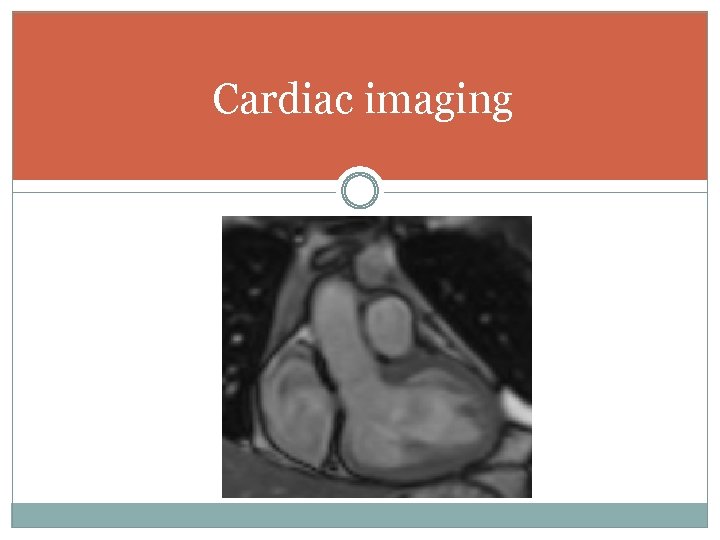 Cardiac imaging 