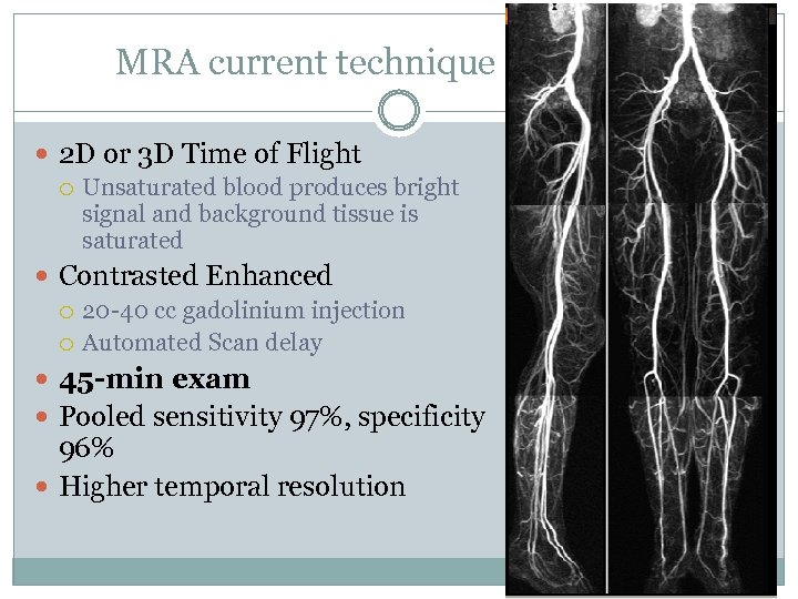 MRA current technique 2 D or 3 D Time of Flight Unsaturated blood produces