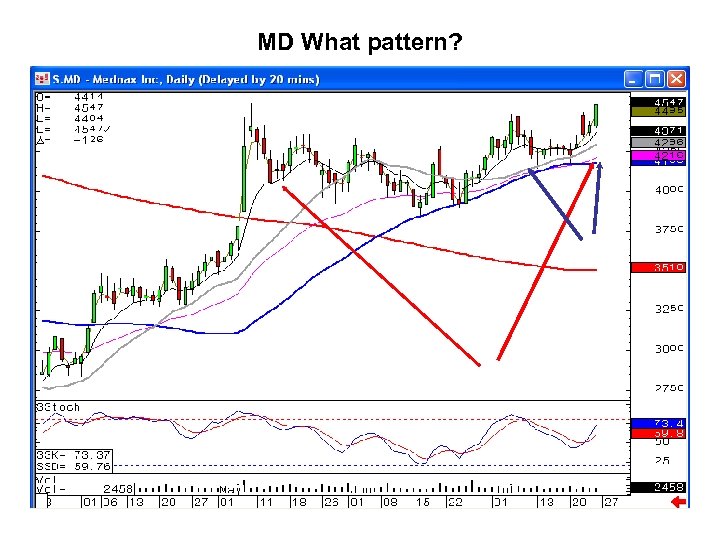 MD What pattern? 