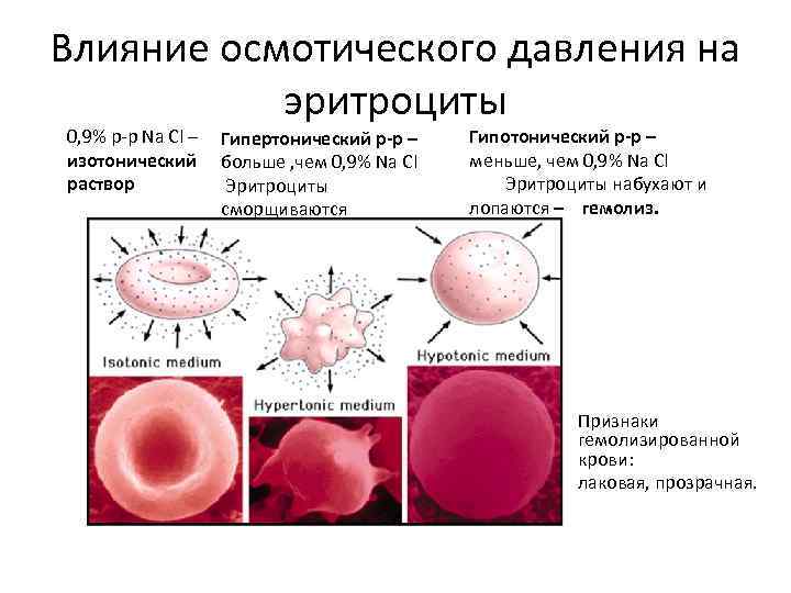 Ученые изучали действие на эритроциты раствора nacl