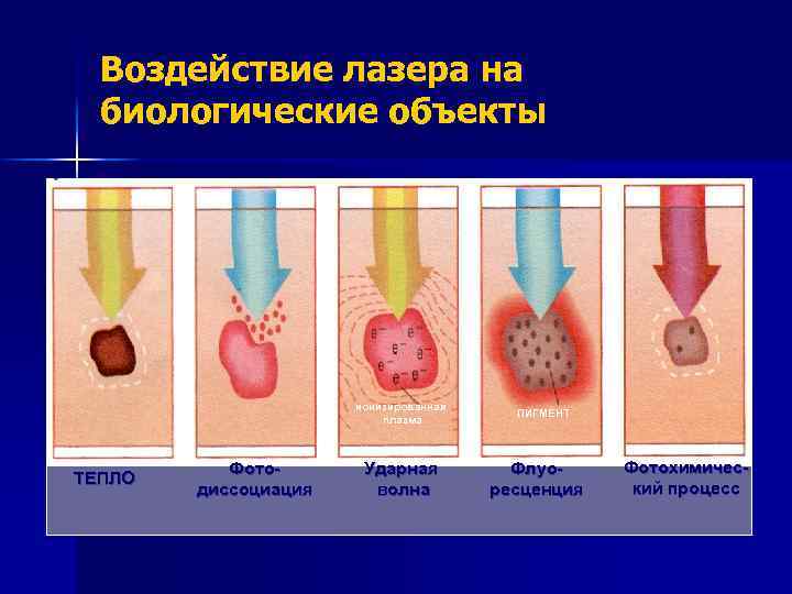 Воздействие лазера на биологические объекты ионизированная плазма ТЕПЛО Фотодиссоциация Ударная волна ПИГМЕНТ Флуоресценция Фотохимический