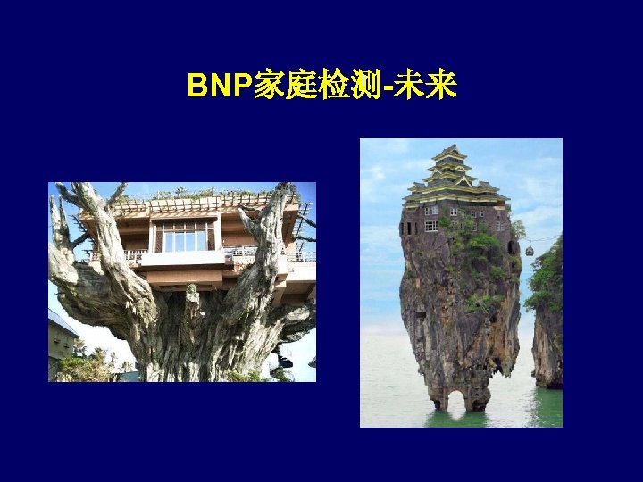BNP家庭检测-未来 