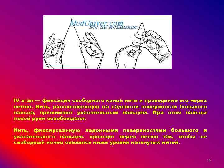 IV этап — фиксация свободного конца нити и проведение его через петлю. Нить, расположенную