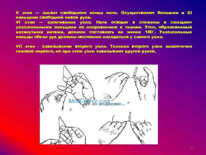 V этап — захват свободного конца нити. Осуществляют большим и III пальцами свободной левой