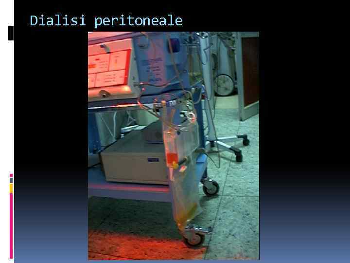 Dialisi peritoneale 