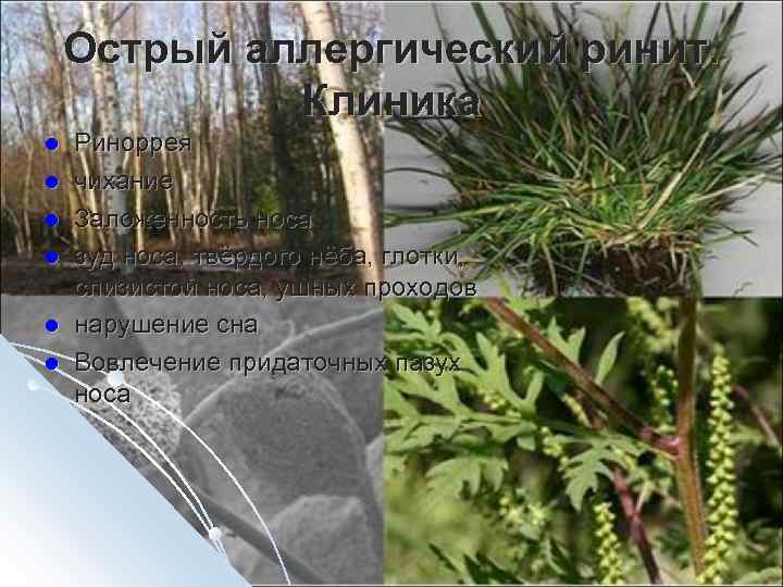 Острый аллергический ринит. Клиника l l l Риноррея чихание Заложенность носа зуд носа, твёрдого