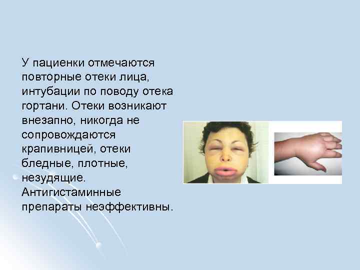 У пациенки отмечаются повторные отеки лица, интубации по поводу отека гортани. Отеки возникают внезапно,