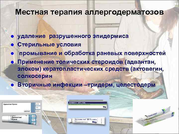 Местная терапия аллергодерматозов l l l удаление разрушенного эпидермиса Стерильные условия промывание и обработка