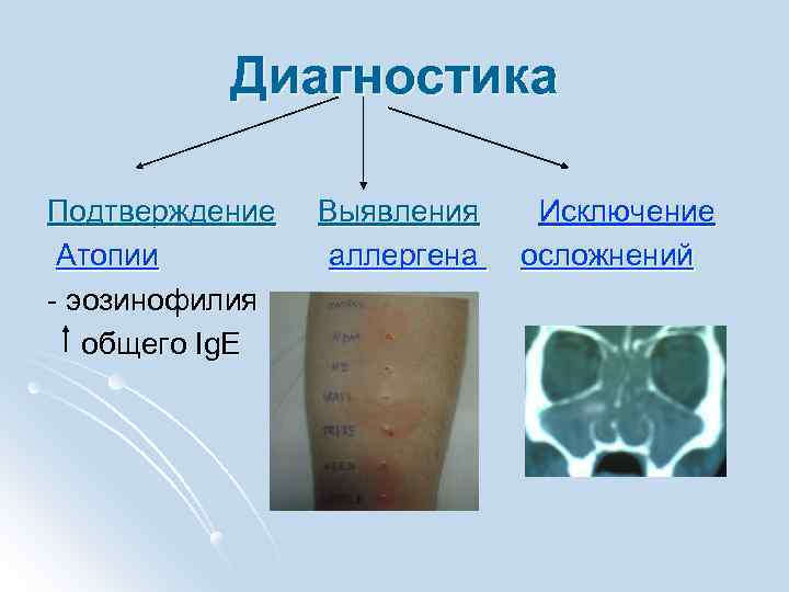Диагностика Подтверждение Выявления Исключение Атопии аллергена осложнений - эозинофилия общего Ig. E 
