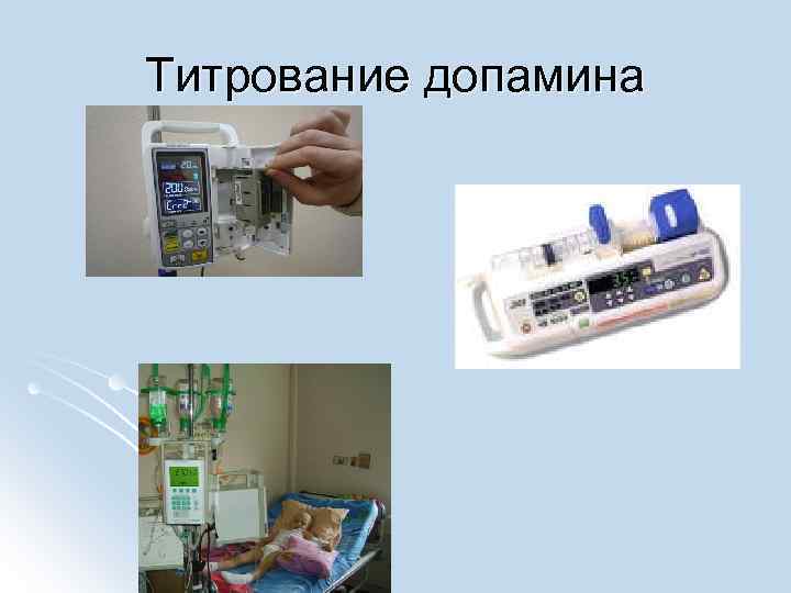 Титрование допамина 