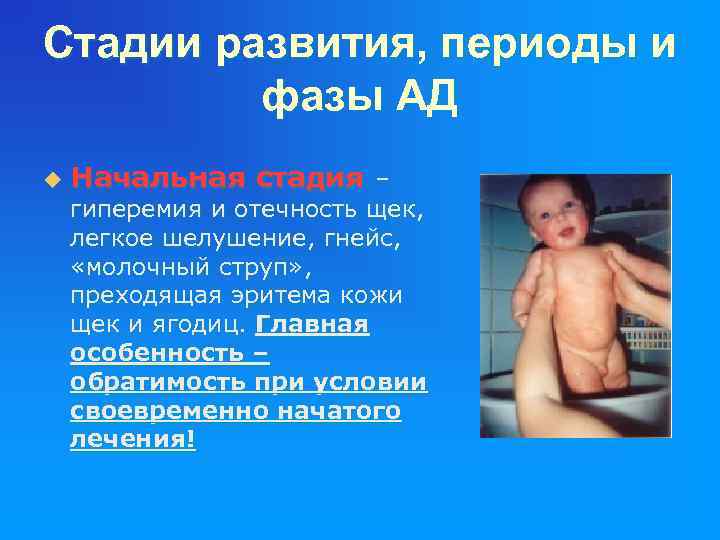 Стадии развития, периоды и фазы АД u Начальная стадия – гиперемия и отечность щек,