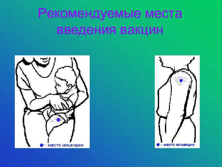 Рекомендуемые места введения вакцин 