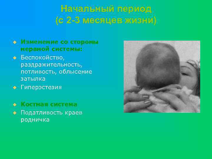 Начальный период (с 2 -3 месяцев жизни) u u u Изменение со стороны нервной