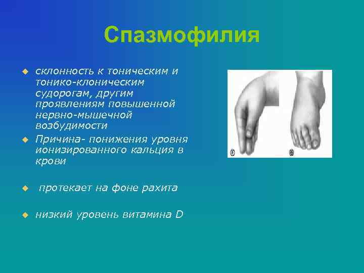 Спазмофилия u u склонность к тоническим и тонико-клоническим судорогам, другим проявлениям повышенной нервно-мышечной возбудимости