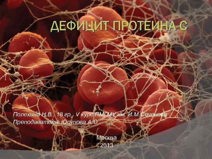 ДЕФИЦИТ ПРОТЕИНА C Полехина Н. В. , 18 гр. , V курс ПМГМУ им.