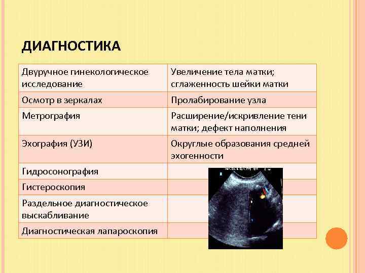 ДИАГНОСТИКА Двуручное гинекологическое исследование Увеличение тела матки; сглаженность шейки матки Осмотр в зеркалах Пролабирование