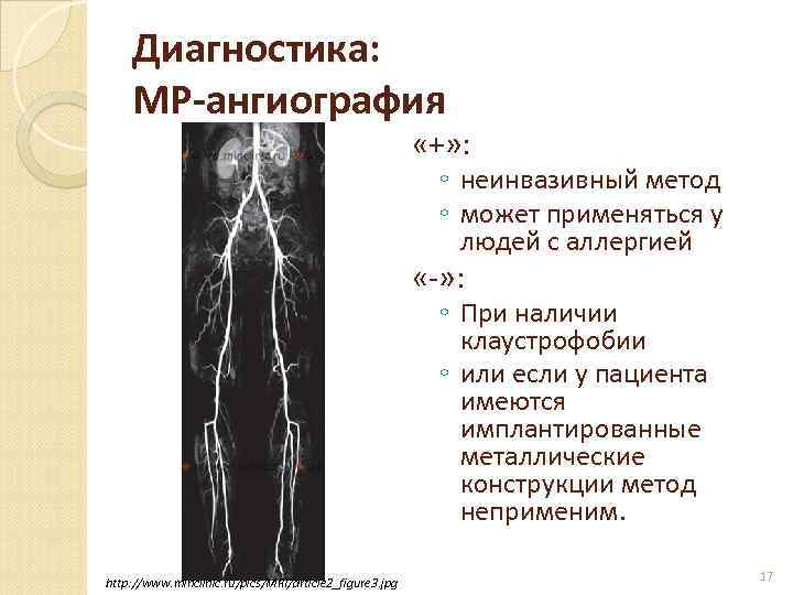 Ишемия нижних конечностей фото