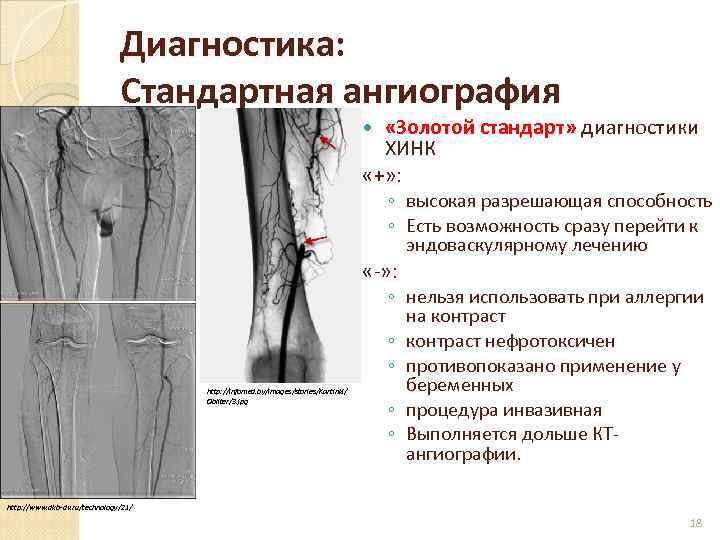 Признаки ишемии конечности