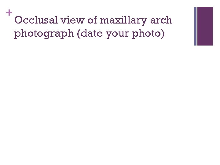 + Occlusal view of maxillary arch photograph (date your photo) 