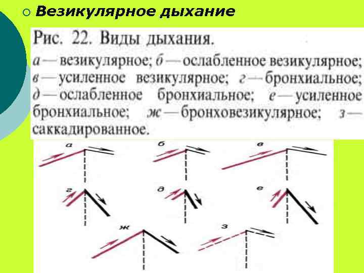 Схемы основных дыхательных шумов