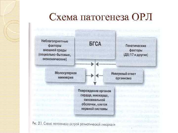 Схема патогенеза ОРЛ 