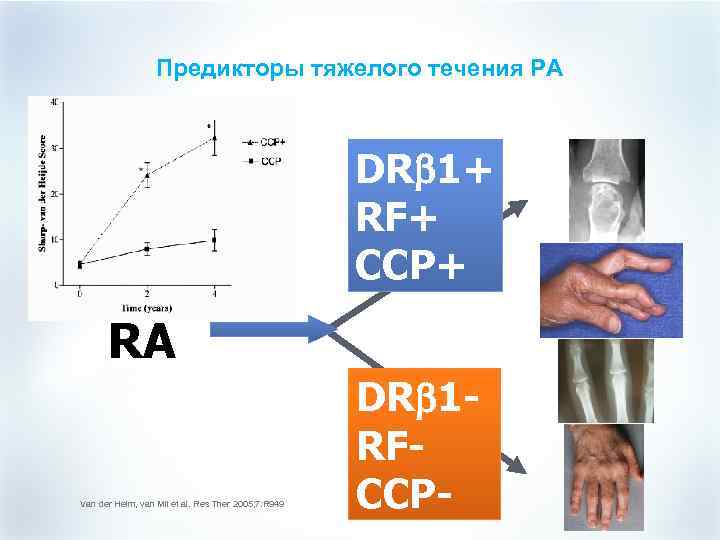 Предикторы тяжелого течения РА DRb 1+ RF+ CCP+ RA Van der Helm, van Mil