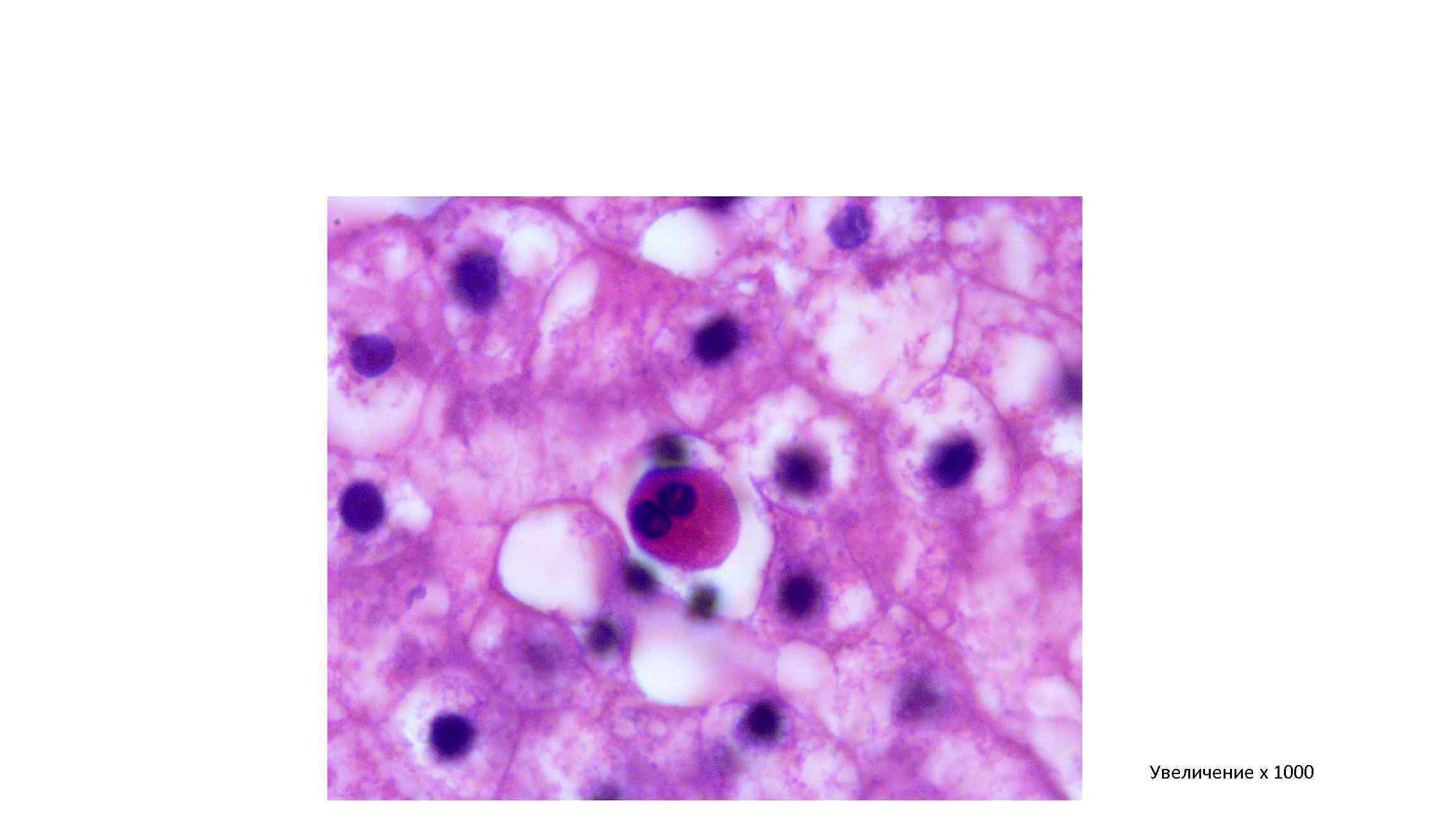 Увеличение х 1000 