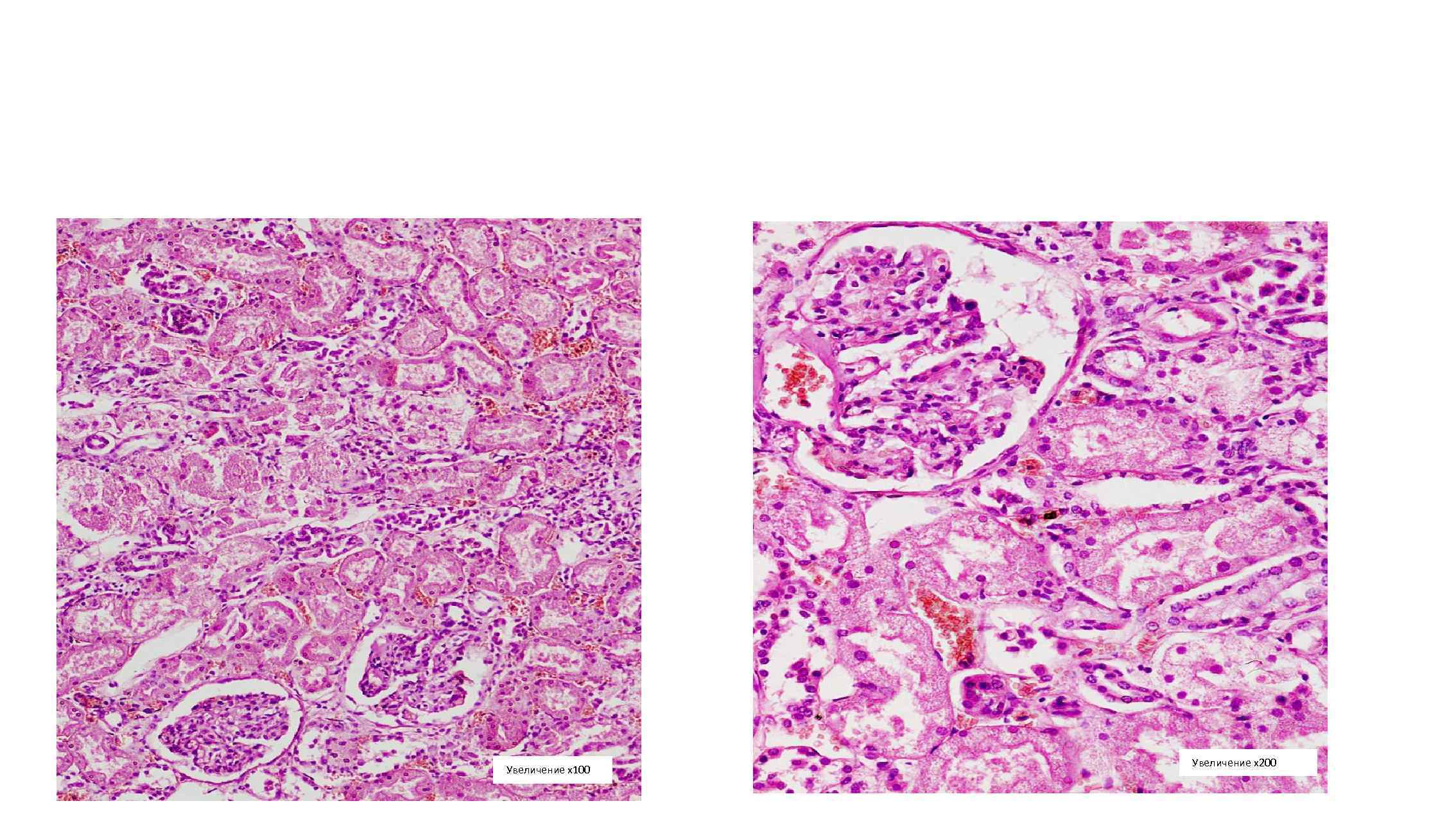 Увеличение х100 Увеличение х200 