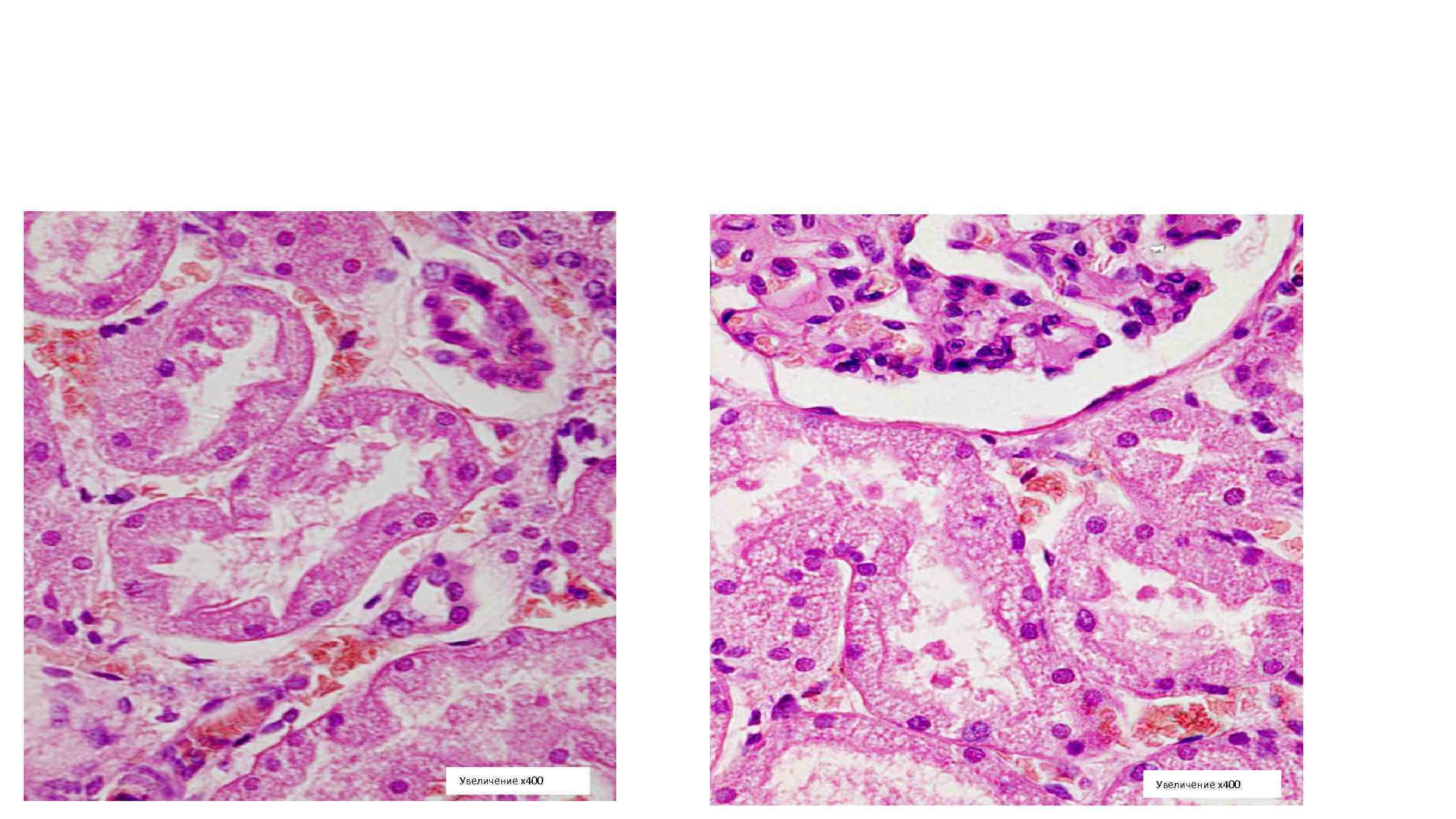Увеличение х400 