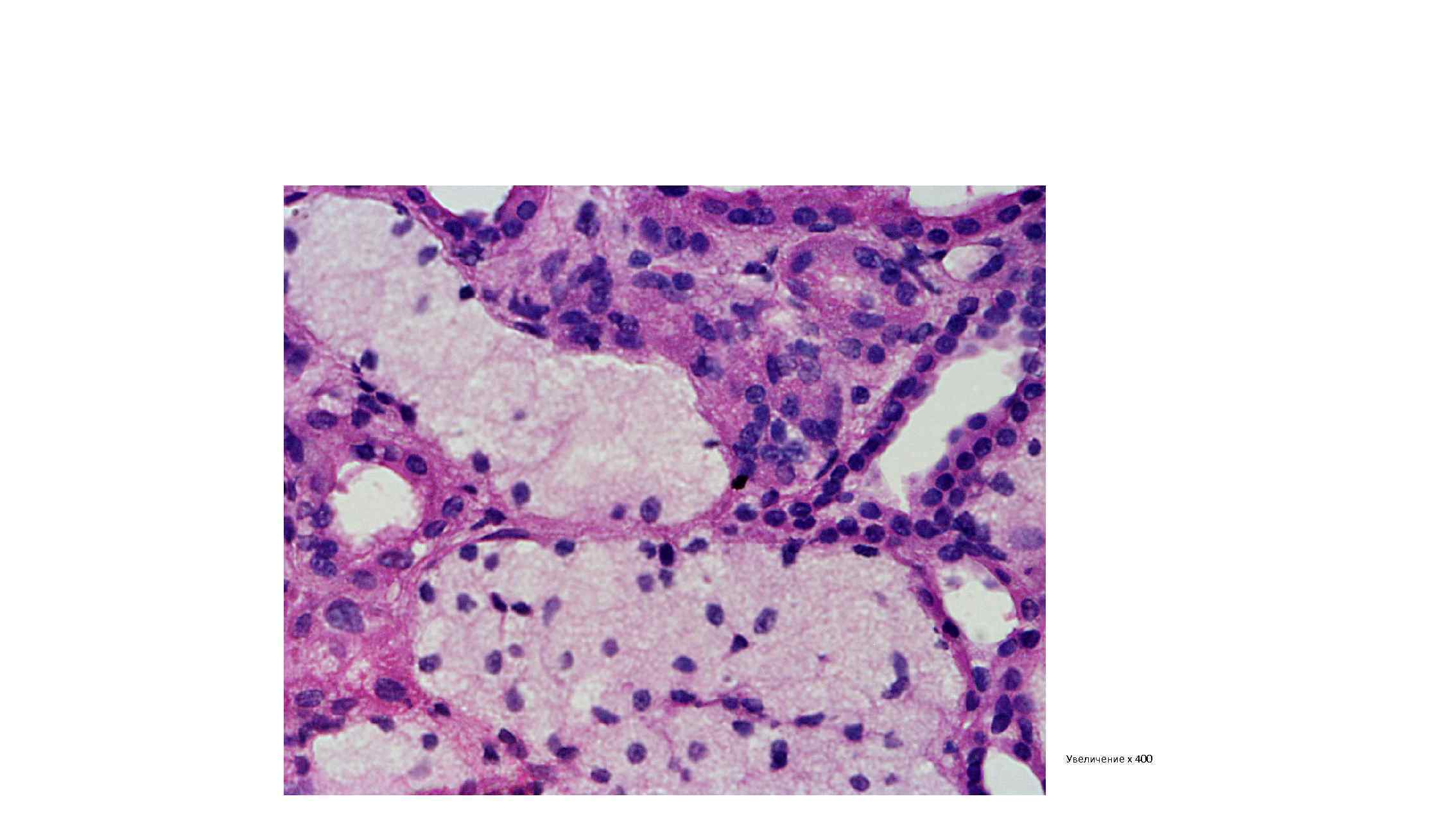 Увеличение х 400 