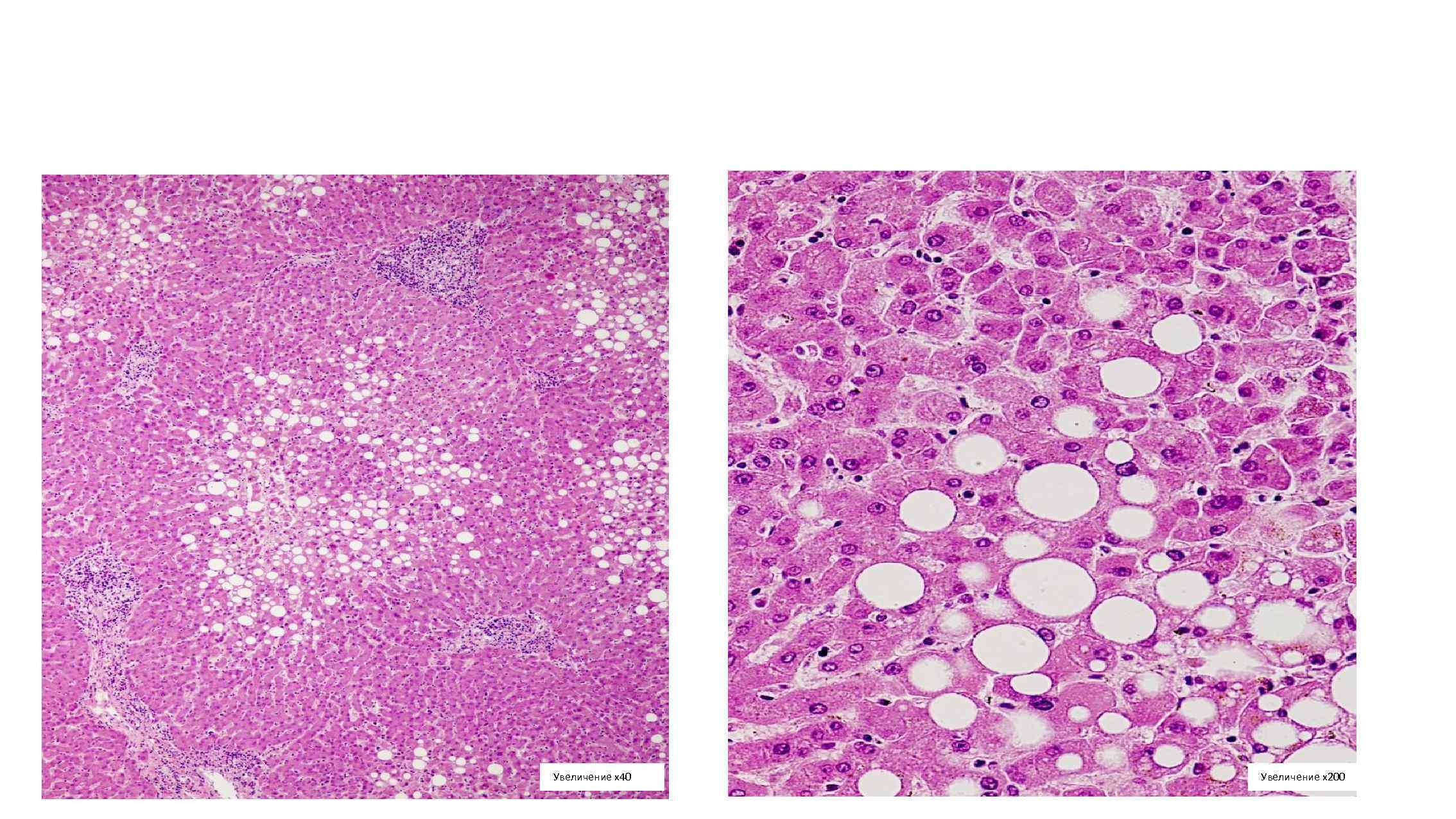 Увеличение х40 Увеличение х200 