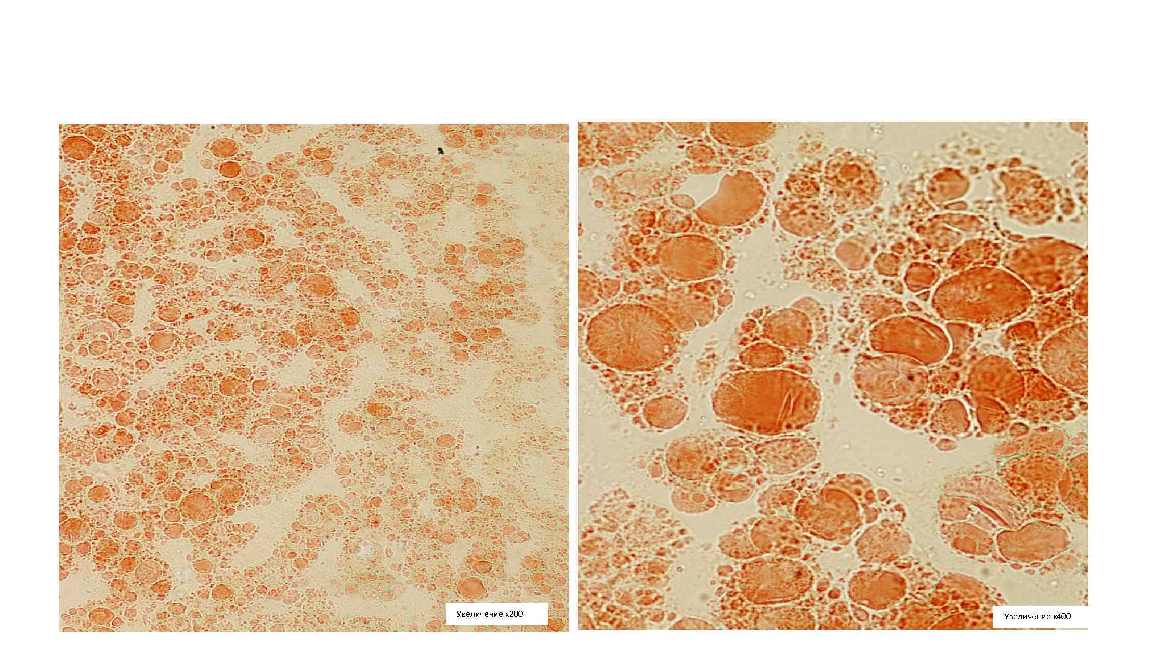 Увеличение х200 Увеличение х400 