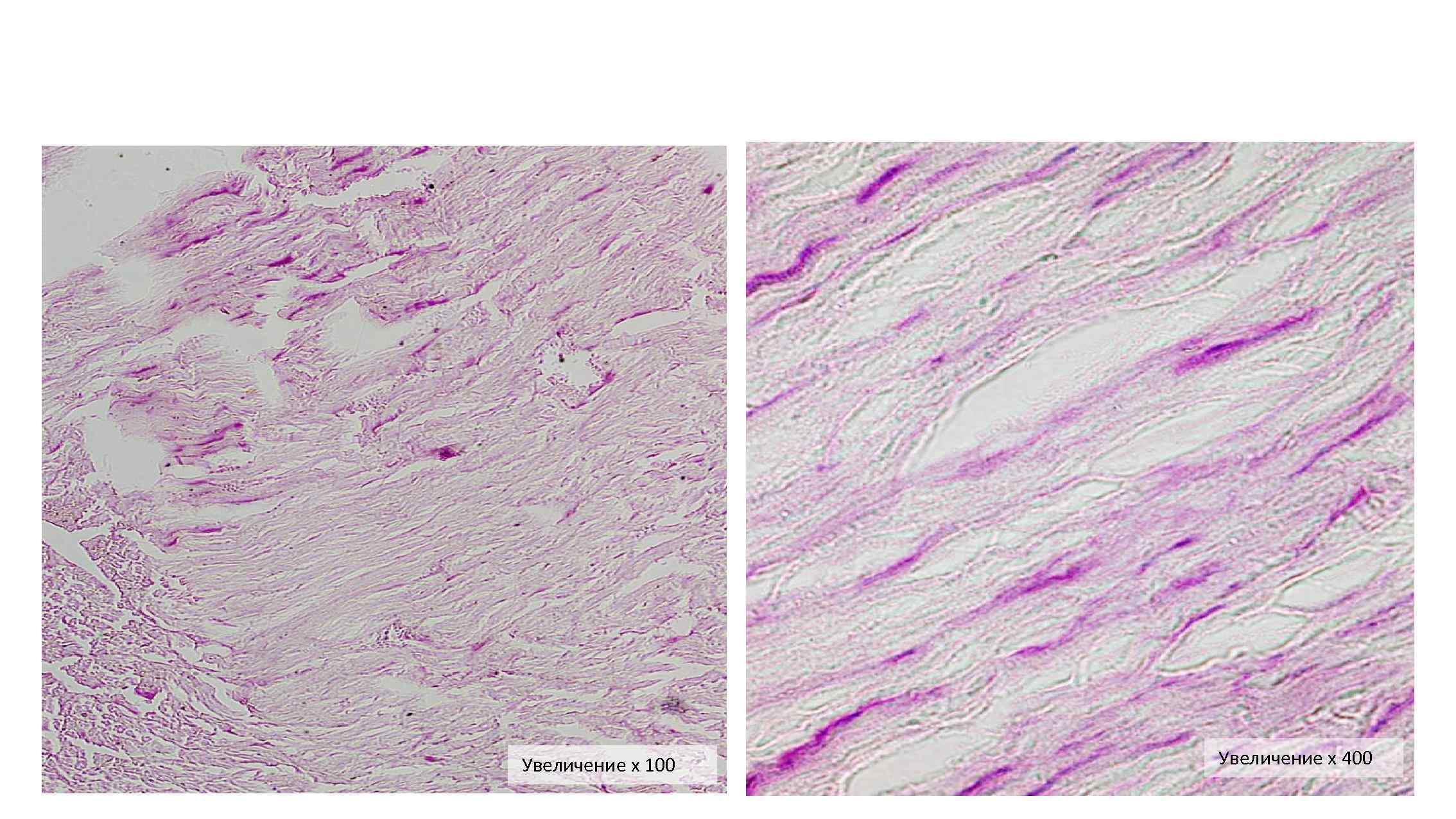 Увеличение х 100 Увеличение х 400 