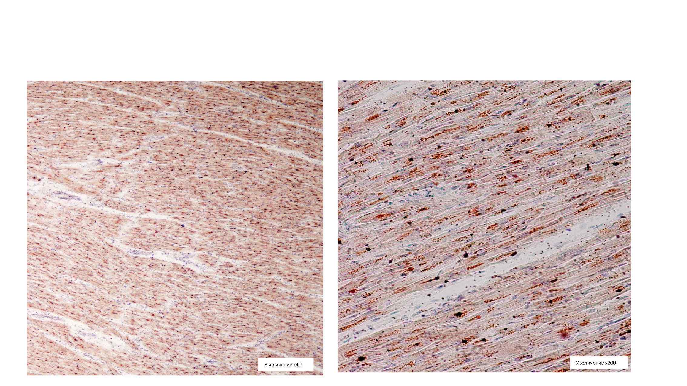 Увеличение х40 Увеличение х200 