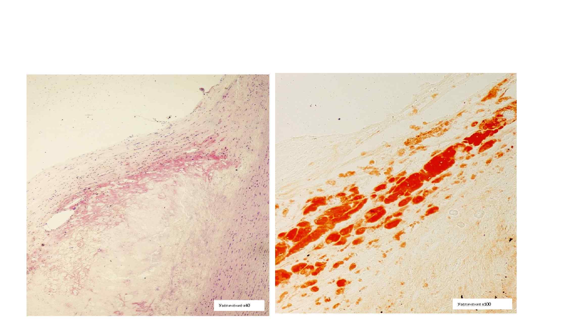 Увеличение х40 Увеличение х100 