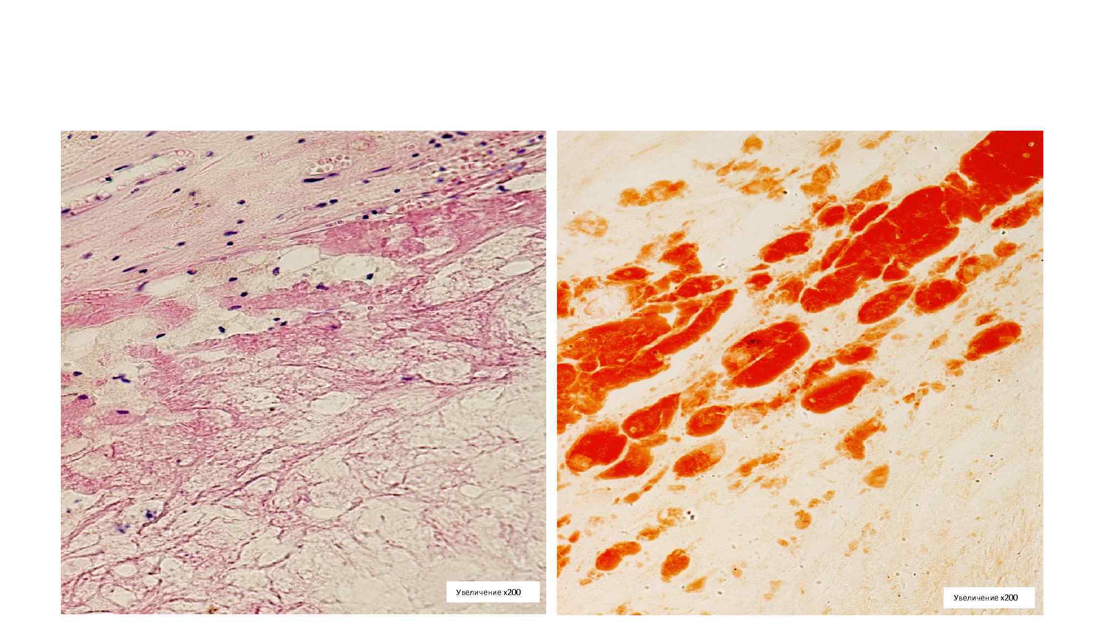 Увеличение х200 
