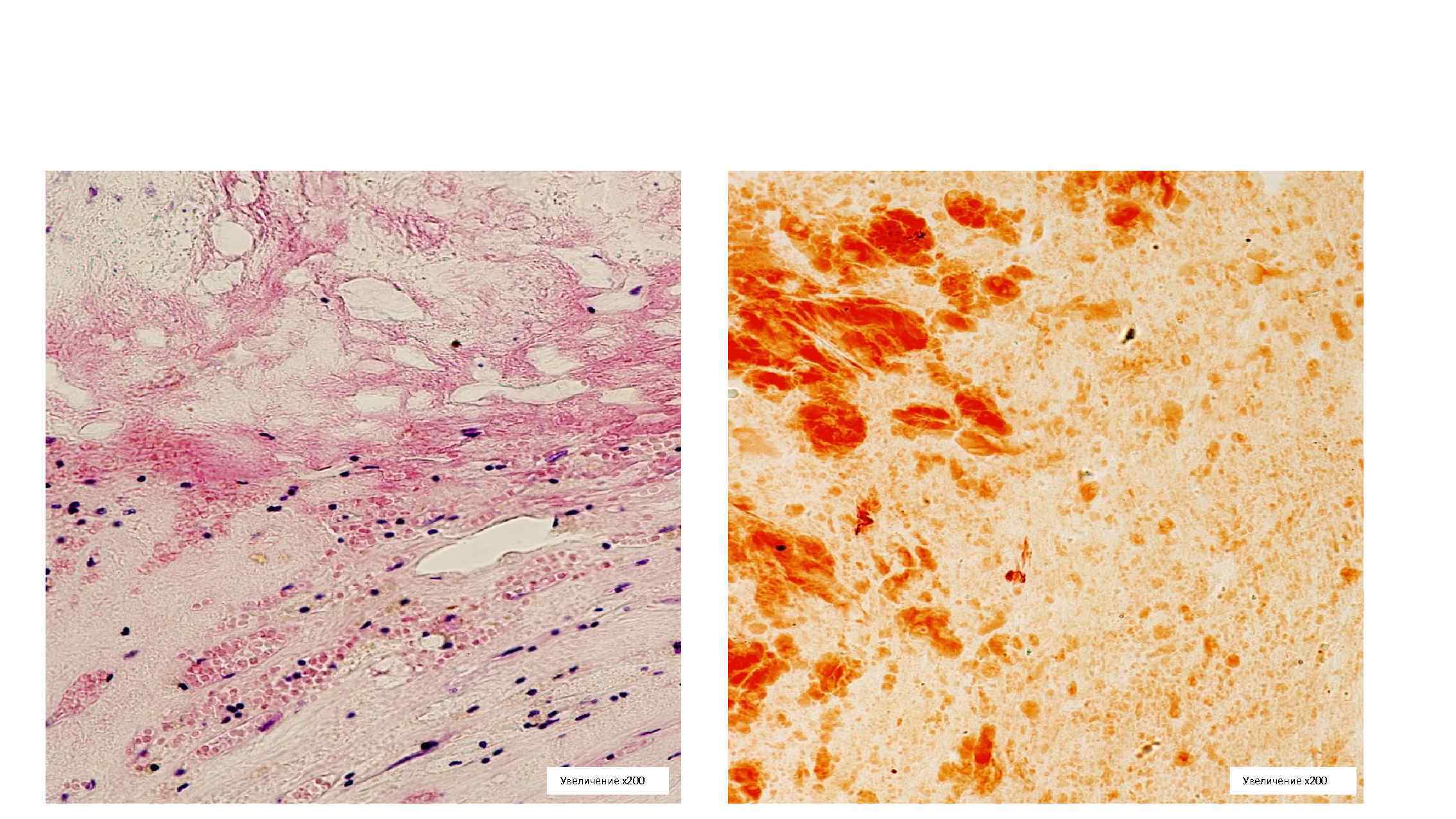 Увеличение х200 