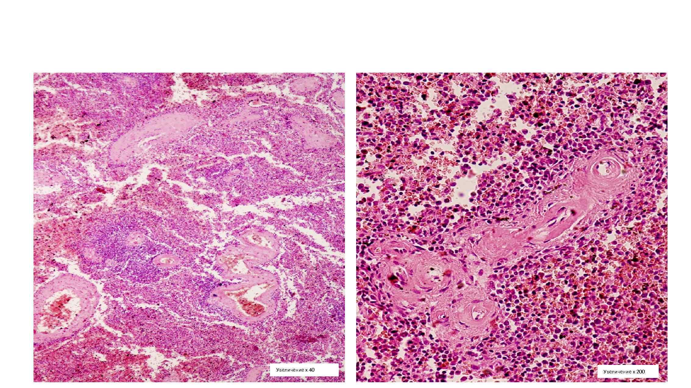 Увеличение х 40 Увеличение х 200 