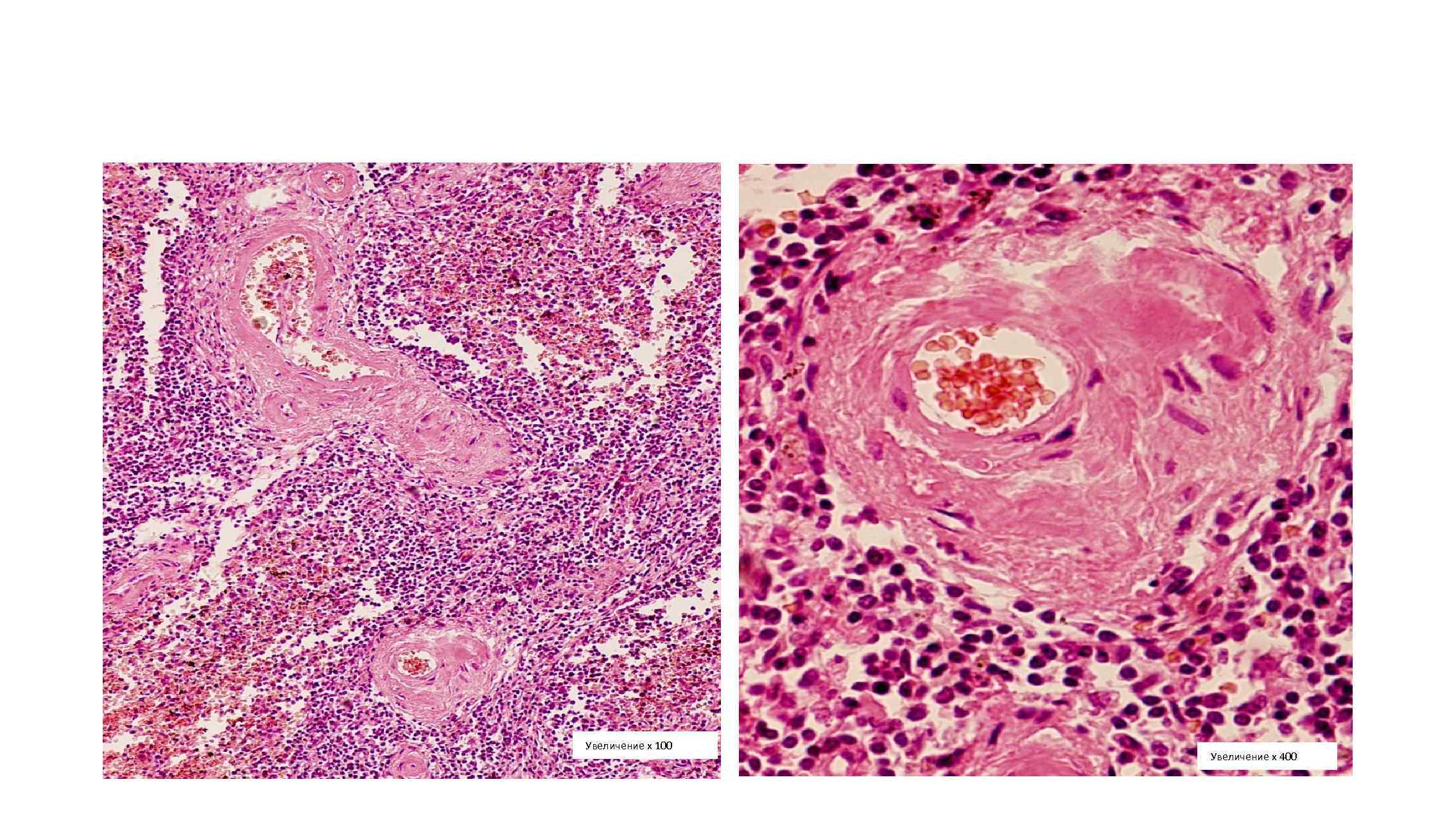 Увеличение х 100 Увеличение х 400 