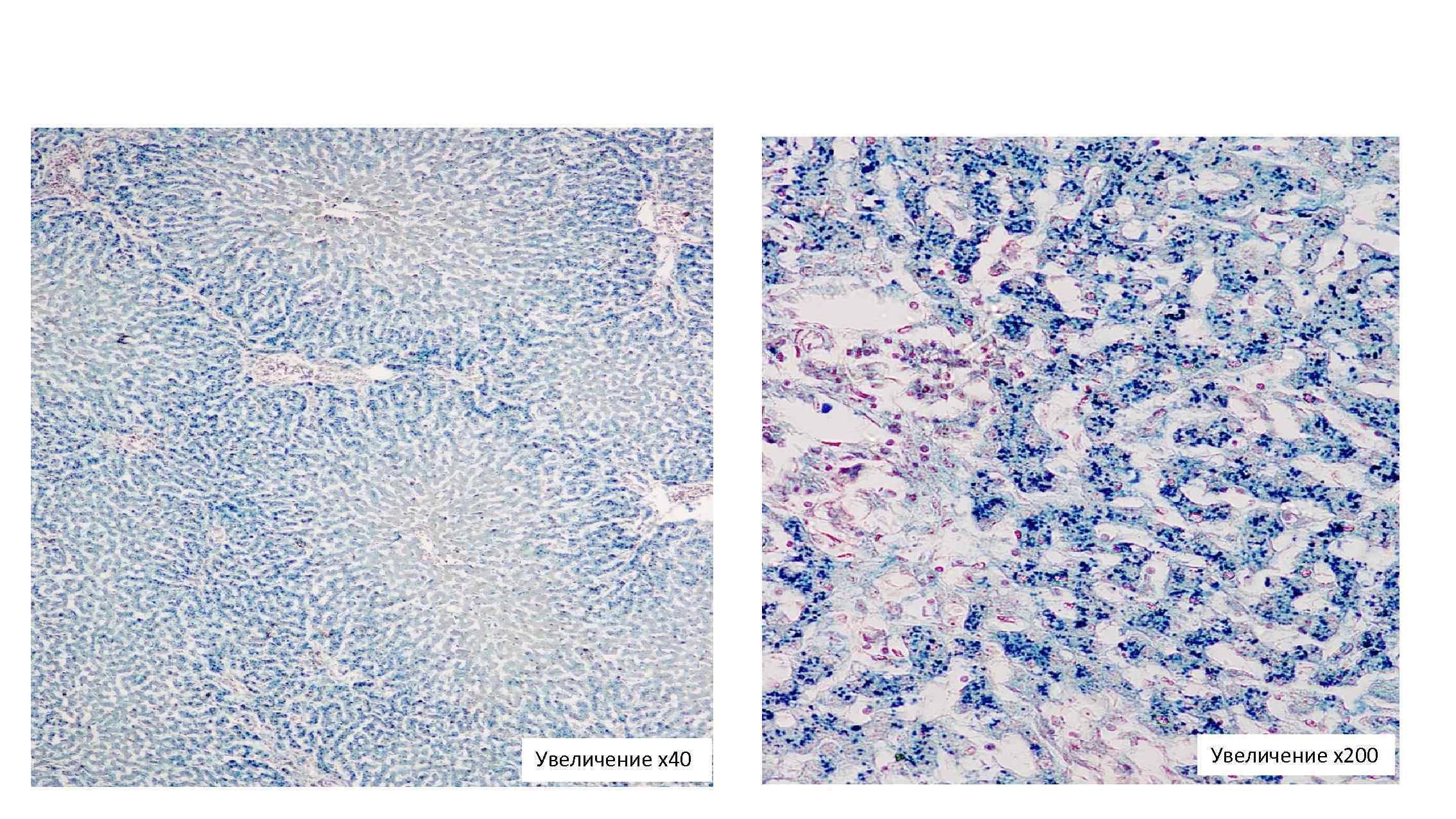 Увеличение х40 Увеличение х200 