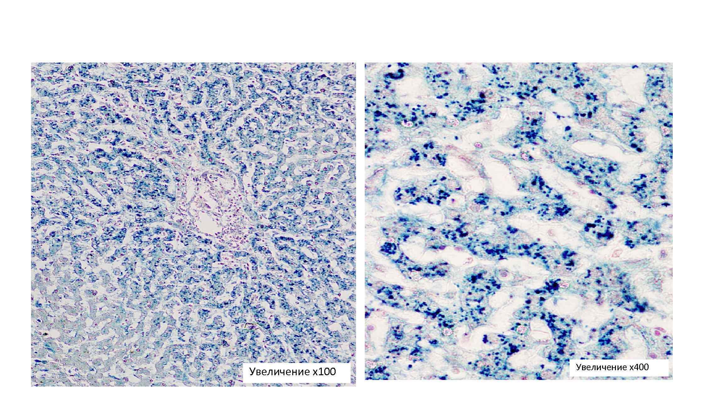 Увеличение х100 Увеличение х400 