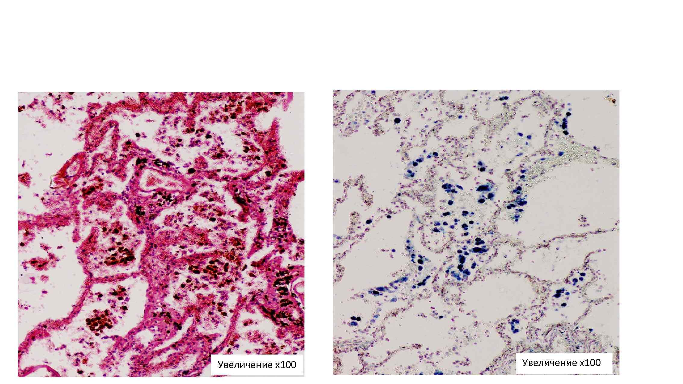 Увеличение х100 