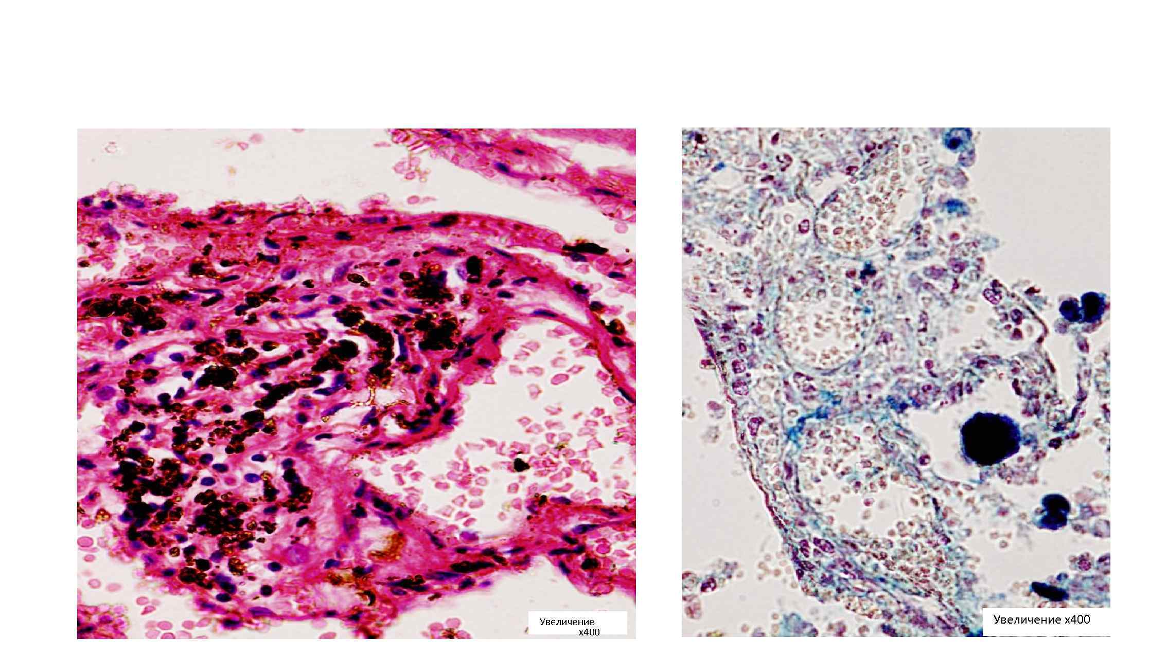 Увеличение х400 