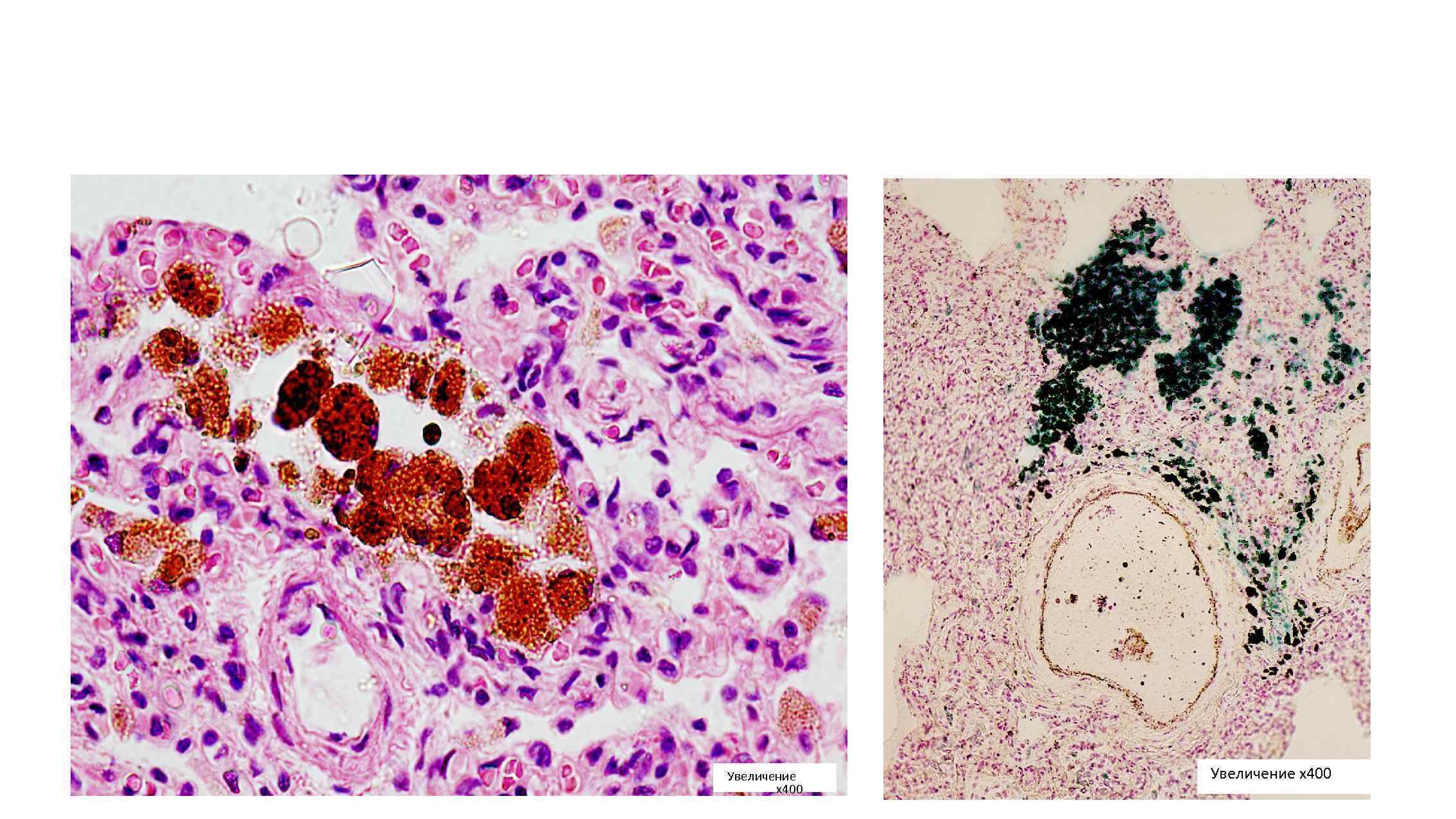 Увеличение х400 