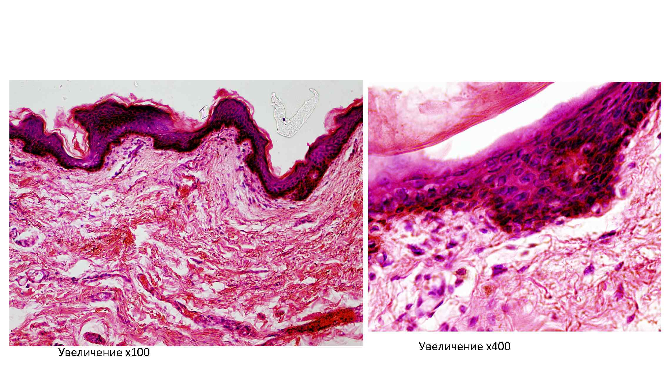 Увеличение х100 Увеличение х400 