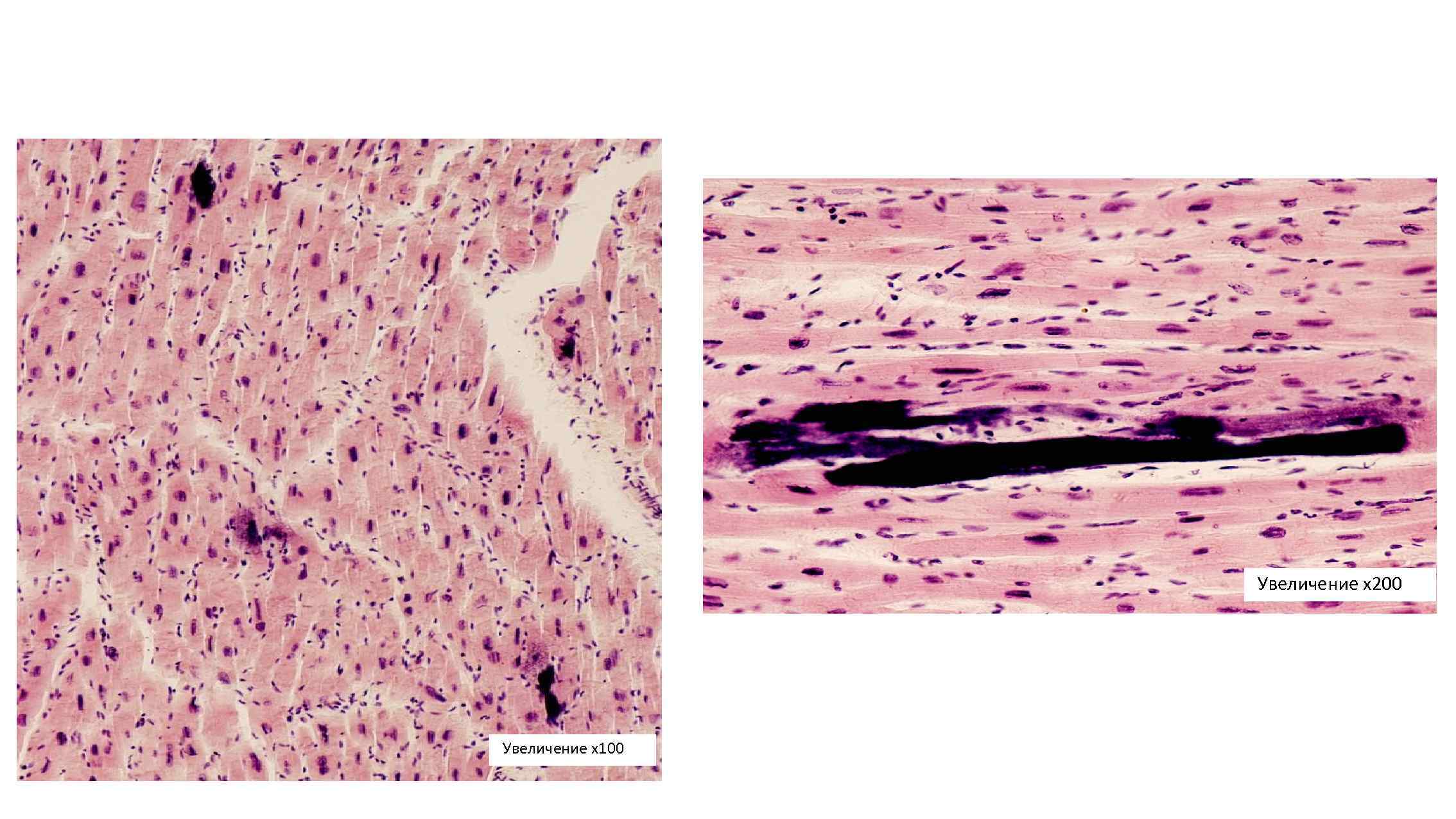 Увеличение х200 Увеличение х100 