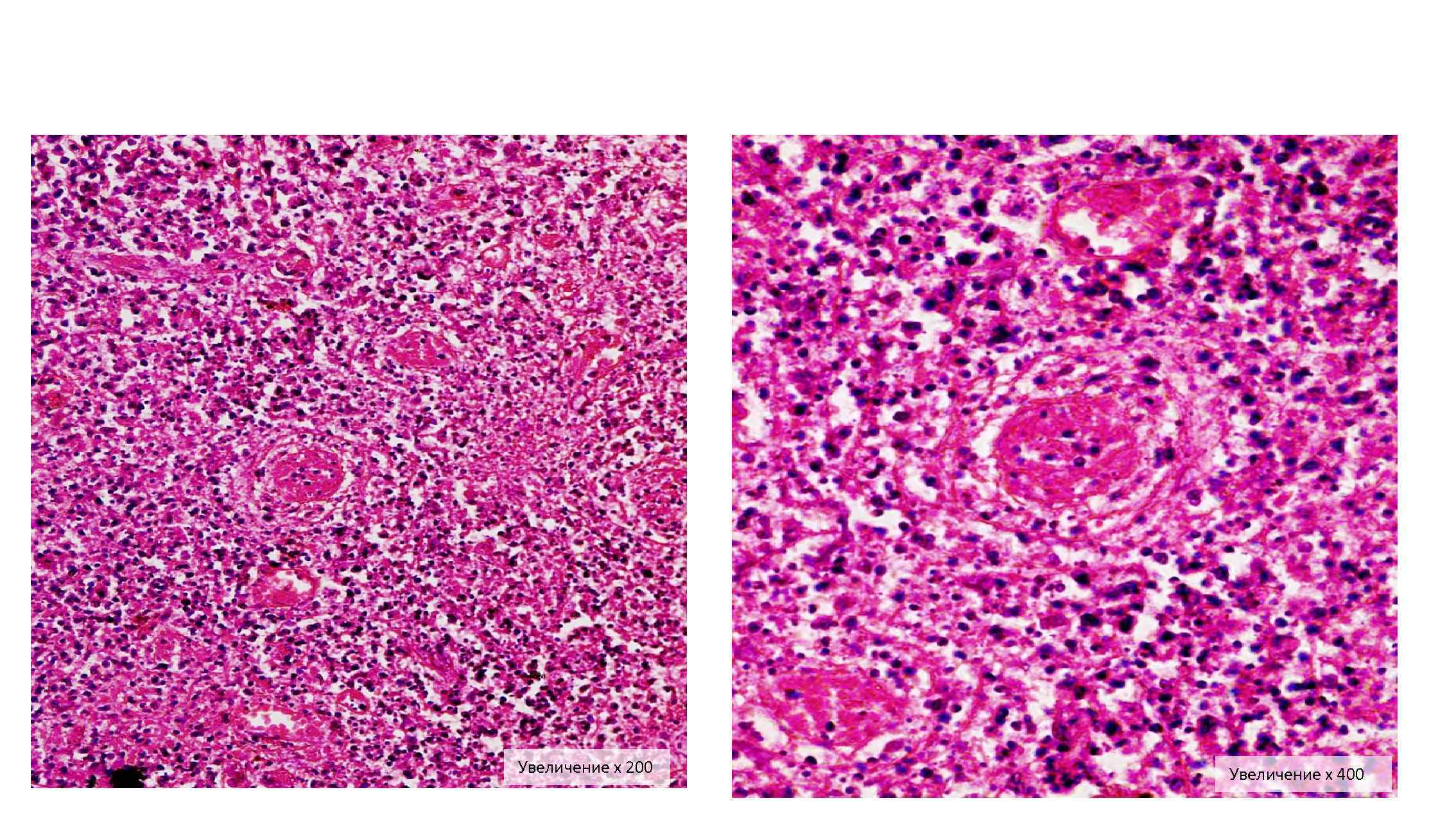 Увеличение х 200 Увеличение х 400 